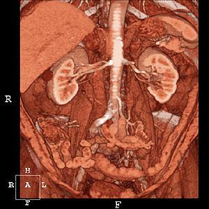 CT Mesenterialregion