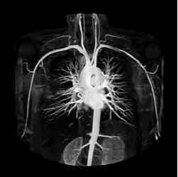 MR Angiographie