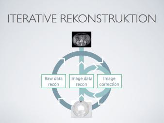 CT: Iterative Rekonstruktion