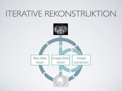 CT: Iterative Rekonstruktion