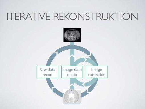 CT: Iterative Rekonstruktion